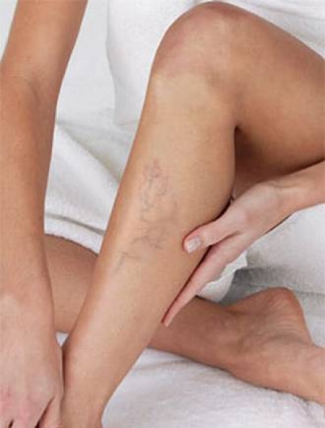 osteopatie viscerala varicoseza de ce se umfla venele la picioare