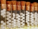 SCANDALOS! Medicamente homeopate celebre produse in conditii jalnice la Ploiesti