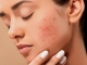 Sfaturi simple care te ajută să calmezi pielea sensibilă